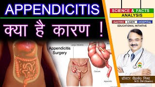 APPENDICITIS क्या है कारण   WHAT CAUSES APPENDICITIS [upl. by Arbas449]