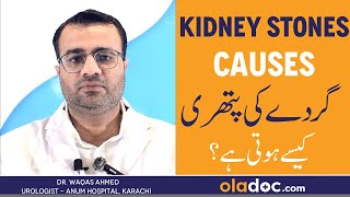 KIDNEY STONES Causes Symptoms amp Treatment  Gurde Ki Pathri Kaise Hoti Hain  Kidney StonesKa Ilaj [upl. by Alahsal]