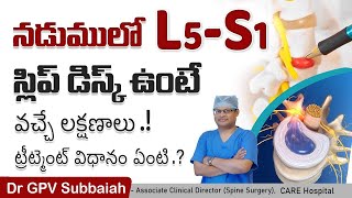 L5S1 disc prolapse symptoms diagnosis amp treatment  Health video  Dr GPV Subbaiah [upl. by Pollak]