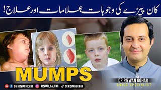 MUMPS SYMPTOMS amp HOME TREATMENT Mumps treatment [upl. by Attevad]