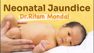 Newborn Jaundice  what to do by DrRitam Mondal MD [upl. by Gustafson263]