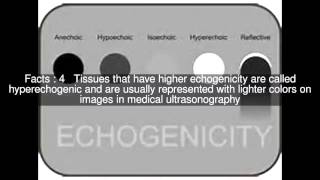 Echogenicity Top 6 Facts [upl. by Rj]