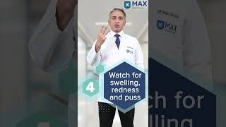 5 tips to treat Skin Ulcers at home  Max Hospital [upl. by Hamer]