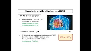 Stereotaktische Radiotherapie beim NSCLC im frühen Stadium  Strahlentherapie Prof Hilke Vorwerk [upl. by Acemahs257]