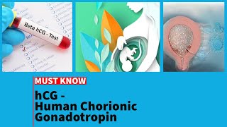 hCG  Human chorionic gonadotropin  betahcg  preganancy  hydatidiform mole  choriocarcinoma [upl. by Riesman397]