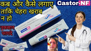 Castor NF skin cream How to use castor nf skin creamCastor NF Skin Cream Uses Or Side Effects [upl. by Khalsa]