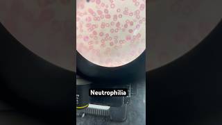 Neutrophilia live microscopy  youtubeshorts youtube [upl. by Aikram649]