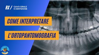 Come interpretare lortopantomografia [upl. by Onfroi]