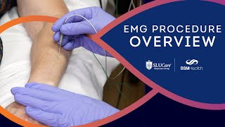 The EMG Procedure Overview of the Nerve Conduction Study Process [upl. by Lalita4]