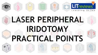 Laser Peripheral Iridotomy Practical Point [upl. by Padegs]