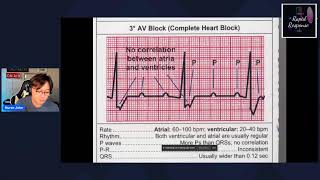 Part 2 Electrocardiography [upl. by Onitram]