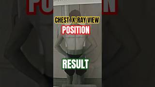 Chest Xray position radiologycareer viralshort viralreels viralvideo chestxrayposition cxrpa [upl. by Aymer]