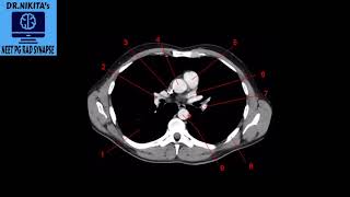 PART2  CT THORAX NORMAL ANATOMY [upl. by Enytsirhc]