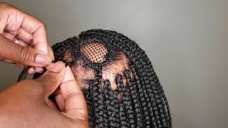 Box Braids Alopecia IGirenesbraids [upl. by Lattonia]