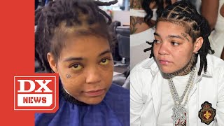 Young MA Opens Up About Hospitalization After Worrying Fans With “Yellow Eye” Video 🙏 [upl. by Micheal476]