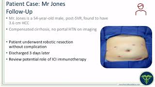 Expert Perspectives The Role of Immunotherapy in Advancing the Treatment of HCC and BTC [upl. by Scrivings32]