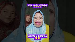 Sindrom🤣🤣🥰 trandingshorts viralvideo tranding fypシ゚viral comedy comedykocak [upl. by Moon]