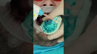 Dental reconstruction in Prague shorts dentist dental short [upl. by Anilram513]