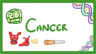 GCSE Biology  What is Cancer Benign and Malignant Tumours Explained 43 [upl. by Aitekram]