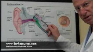 quotTreatable Causes of Hearing Lossquot Hearing Loss Newton MA Part 2 [upl. by Anavrin]