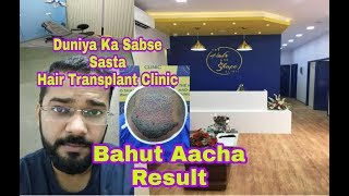 10 Rs Per Graft Hair Transplant  Cheap And Best Hair Transplant Clinic In India [upl. by Avictor]