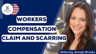 Brooks Law Firm  Workers Compensation Claim and Scarring [upl. by Safoelc]