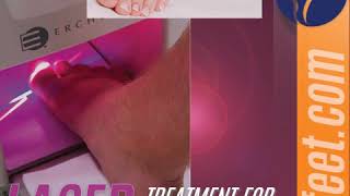 Lunula Laser  Toenail Fungus Therapy [upl. by Gusti]