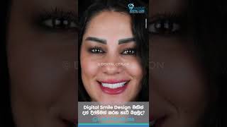 Digital Smile Design මඟින් දත් දීප්තිමත් කරන හැටි බලමුද [upl. by Powe]