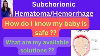 Subchorionic Hematoma My baby is safe or not Medications for Subchorionic hematoma [upl. by Yatnohs]