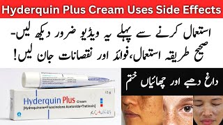 Hyderquin Plus Cream Uses In Urdu  Hyderquin Plus Cream Side Effects [upl. by Kristos]