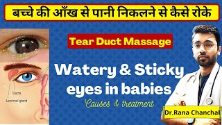 Sticky eyes in babies Causes amp treatment  Tear duct NLD Massage [upl. by Hara227]