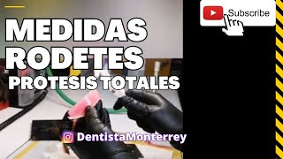 🤔CUÁNTO MIDEN ❓Los RODETES de CERA 👅 Prótesis TOTALES [upl. by Hamlen262]