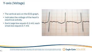 The ECG Graph [upl. by Goodkin124]