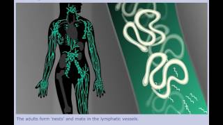 Lymphatic Filariasis Elephantiasis  Life Cycle [upl. by Sylado]