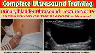 Urinary bladder Ultrasound  Bladder Scan  usg  Sonography [upl. by Savior]