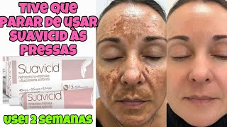 VOU PARAR DE USAR SUAVICID com APENAS 2 SEMANAS de USO  MELASMA VOLTOU “DESMAME PRECOCE” [upl. by Pirali761]