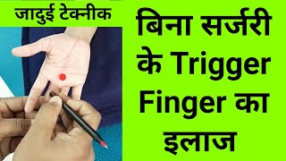 amazing massage technique for trigger finger treatment at home  cure trigger finger without surgery [upl. by Aisayt958]