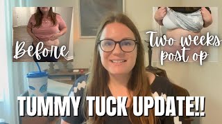 Two week tummy tuck update  What no one tells you and stomach beforeafter [upl. by Hgielrebmik]