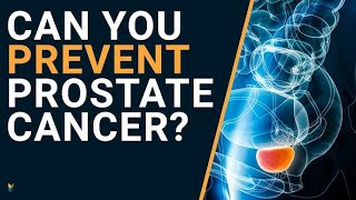 Prostate Cancer Symptoms Early Detection amp Prevention [upl. by Jacquetta185]