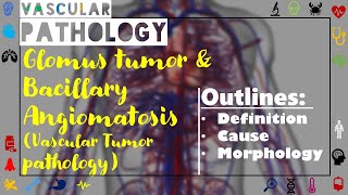 Glomus Tumor And Bacillary angiomatosisVascular tumor pathologyDefinitionCausesMorphology [upl. by Tia]