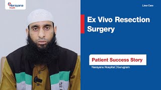 Success Story of Patient’s Ex Vivo Resection Surgery  Dr Sanjay Goja [upl. by Rise135]