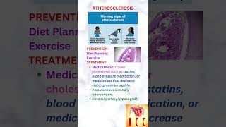 Atherosclerosis neetpg neet usmleprep usmle [upl. by Tillion]