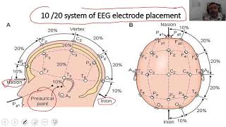 How to place electrodes for EEG 10 20 system of Electrode Placement  EEG electrode placement map [upl. by Suolekcin]