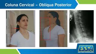 Aula 3  TR de Coluna Cervical  Protocolos Especiais [upl. by Aitahs]