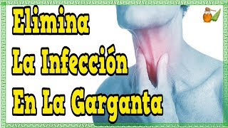 Que Tomar Para El Dolor De Garganta  Elimina La Infeccion En La Garganta [upl. by Bellis309]