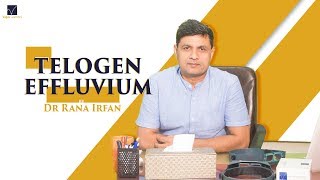 Telogen Effluvium  By Dr Rana Irfan [upl. by Aerdna]