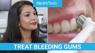 How to treat bleeding gums at home [upl. by Llehsor]