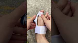 Part 01 Hallux Valgus Correction Good Things RecommendationBigfootboneviralvideoytshorts [upl. by Mcdonald]