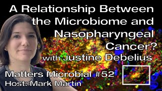 Matters Microbial 52 A relationship between the microbiome and nasopharyngeal cancer [upl. by Mesics]