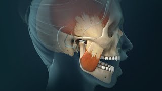 TMJ Pain Headaches Earaches and Spasms [upl. by Nidraj]